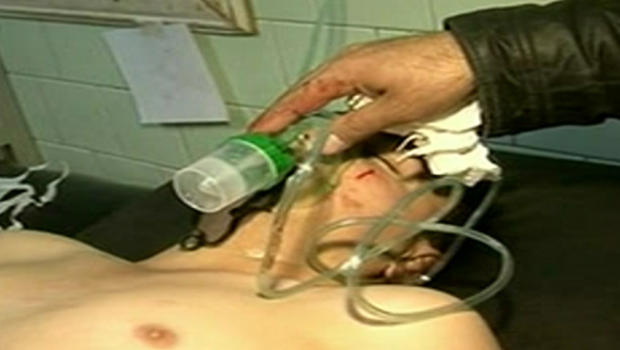 Западни савезници у Сирији користе хемијско оружје против народа Сирије (видео)