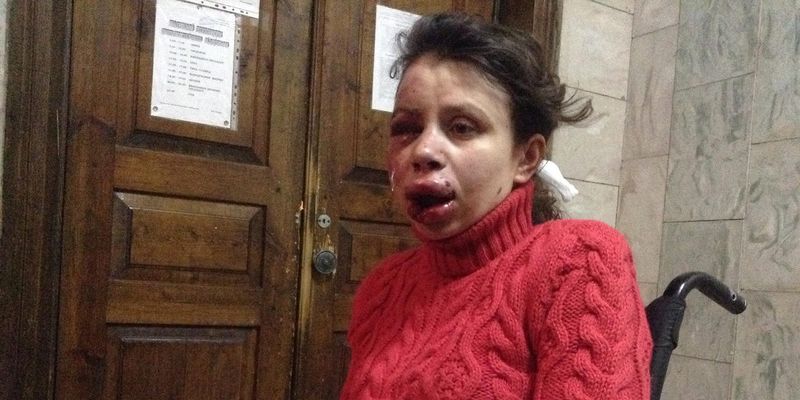 Кличко наредио брутално премлаћивање украјинске новинарке Чорновил како би поново дао замајац протестима?