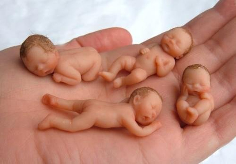 Србија: Више абортуса него рођене деце у 2014.