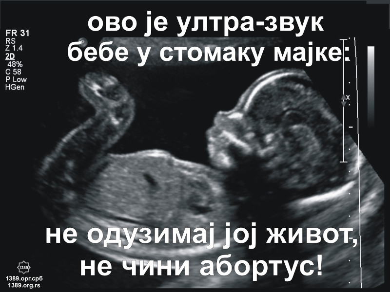 У Србији се годишње обави више абортуса него што се роди беба