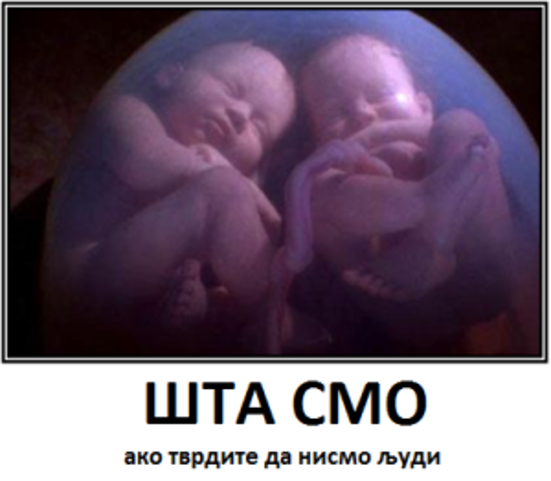 Уместо Дана беба Србија треба да уведе Дан смрти! У Србији се годишње обави између 150.000 и 200.000 абортуса