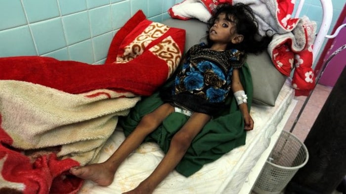 Милиони деце гладују у Јемену