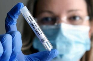 Светска здравствена организација признала да је сваки ПЦР тест потенцијално нетачан
