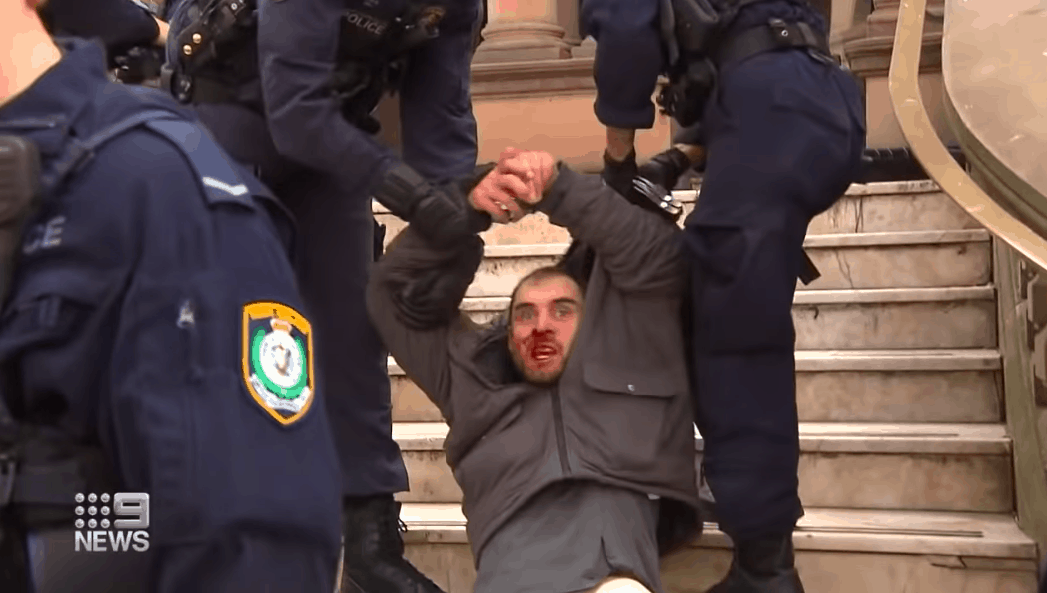 БОРБА ЗА СЛОБОДУ: Полиција у Аустралији послала коњицу да гази људе јер су против ковид мера! (видео)